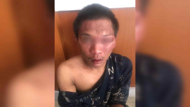 Terciduk Curi Motor, Pemuda ini Babak Belur di Hajar Warga